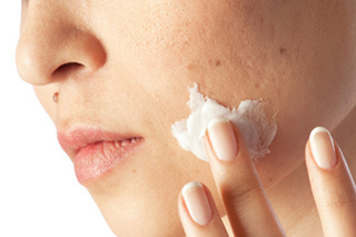 acne treatment home remedies