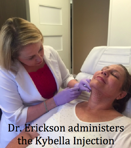 Watch as Dr Erickson explains the Kybella Procedure here