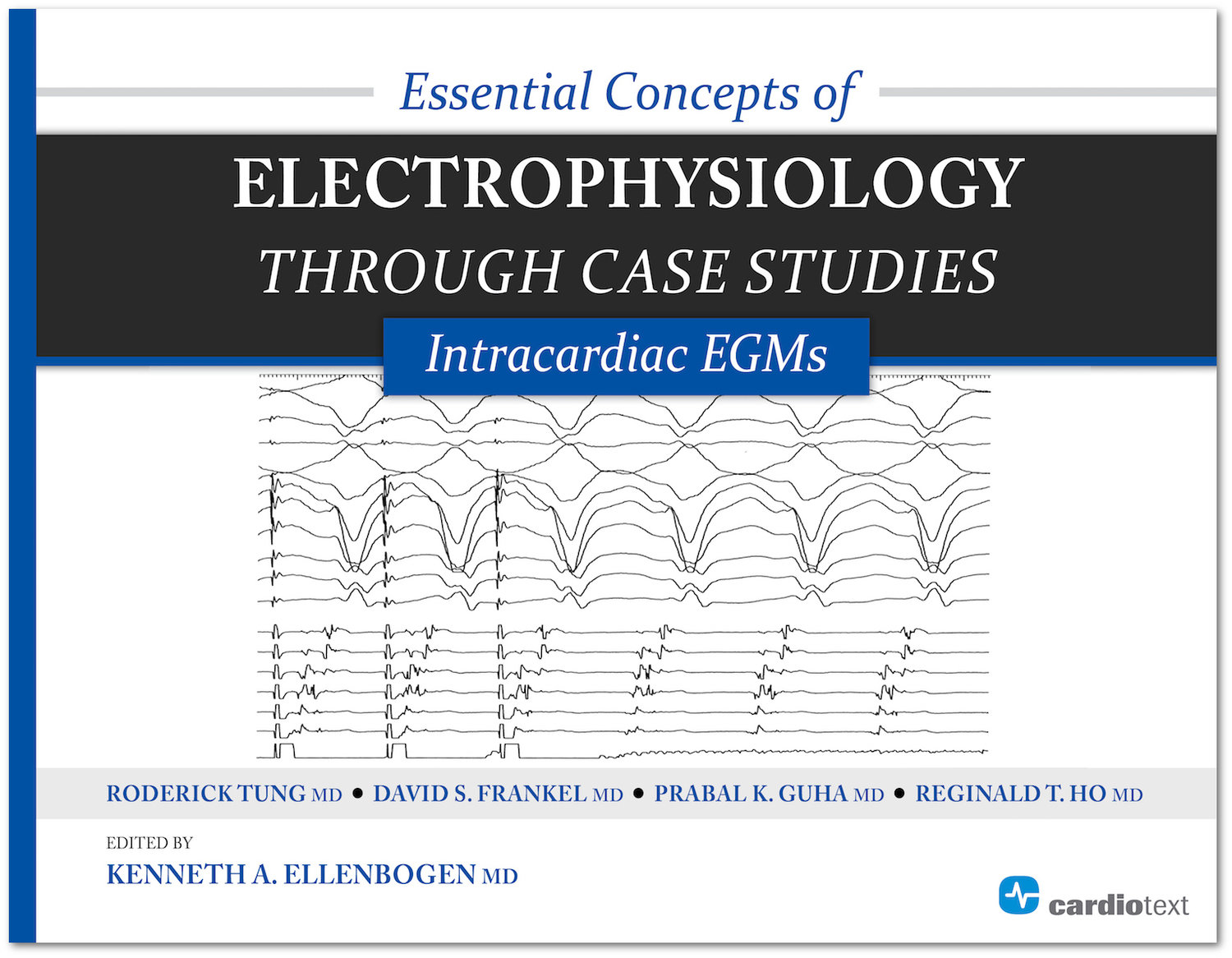 Essential Concepts of Electrophysiology through Case Studies: Intracardiac  EGMs - Ellenbogen 9781935395331 — Cardiotext Publishing - Cardiology Books  and eBooks