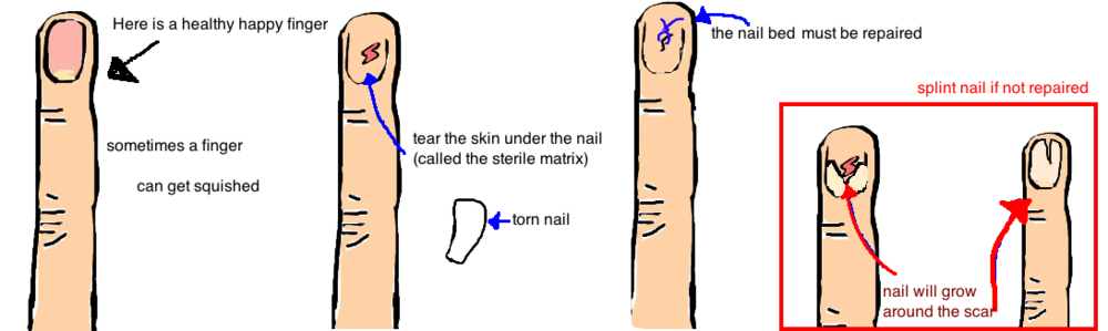 Common Fingernail Problems and Fingernail Diseases
