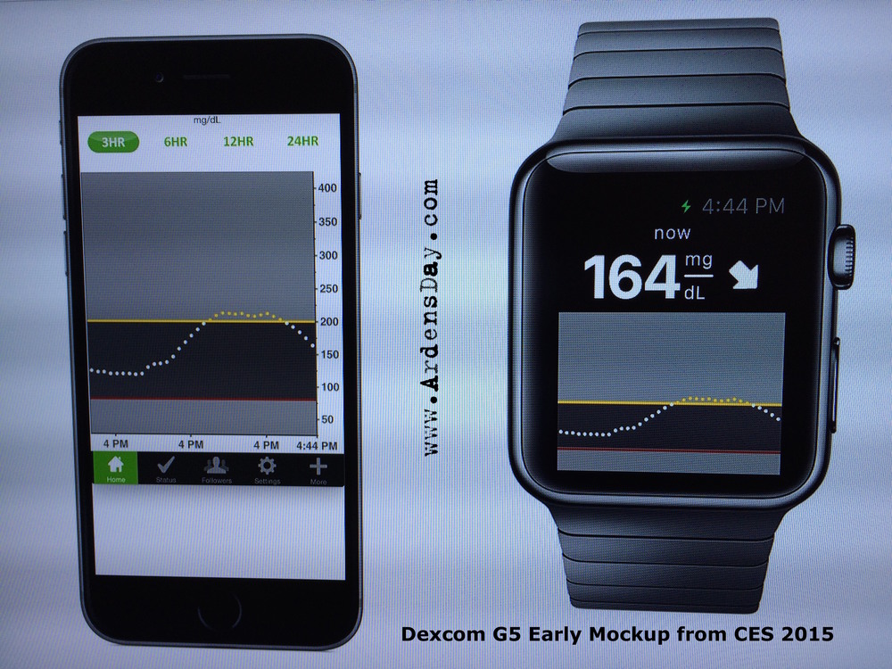 Dexcom G5 Early Mockup on iWatch and iPhone — Arden's Day and The Juicebox Podcast