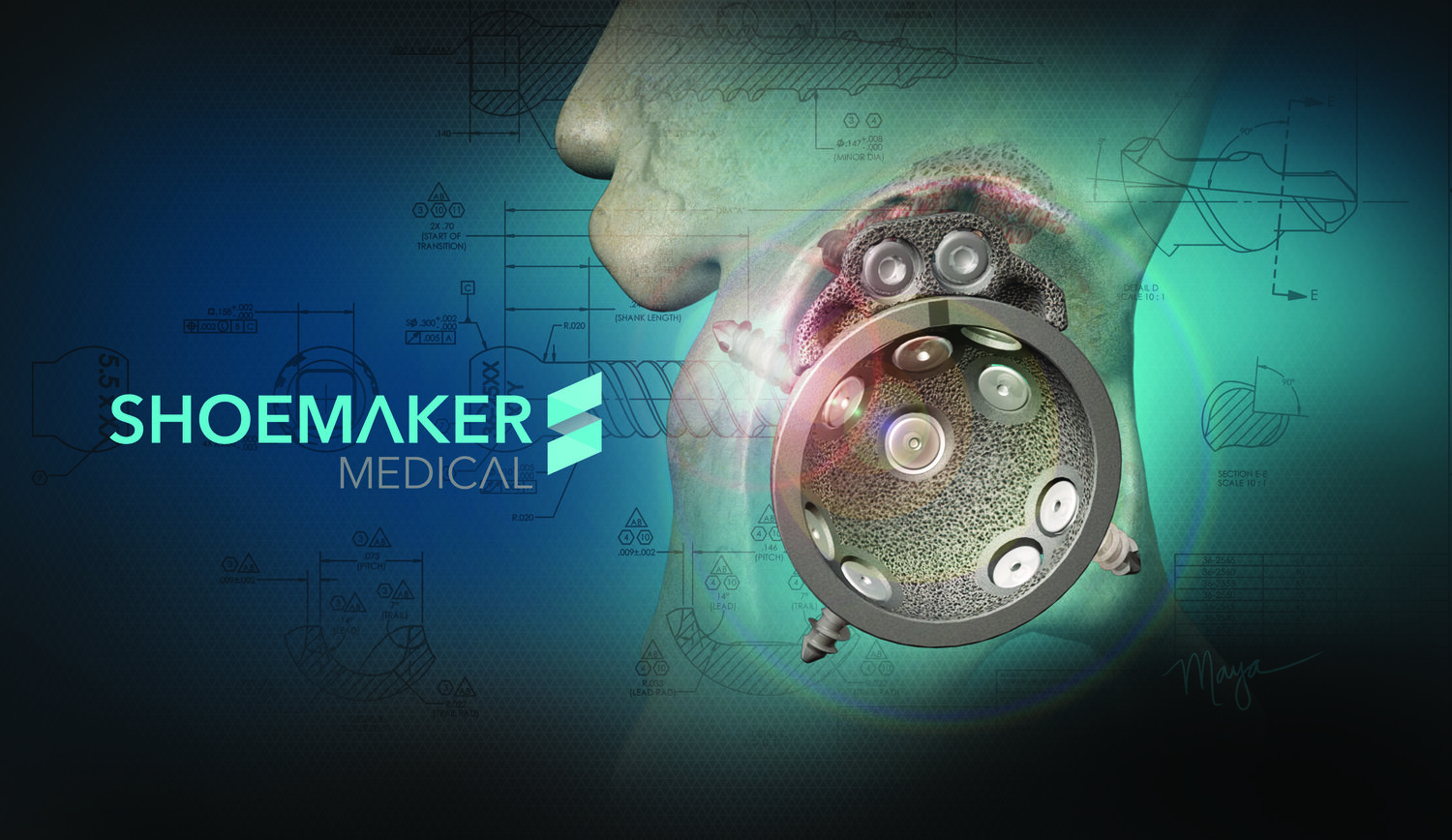 A One-Page Guide to Writing Medical Device Animation Scripts — Shoemaker  Medical
