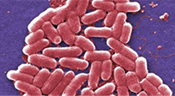 E. Coli bacteria under a microscope (c) Center for Disease Control