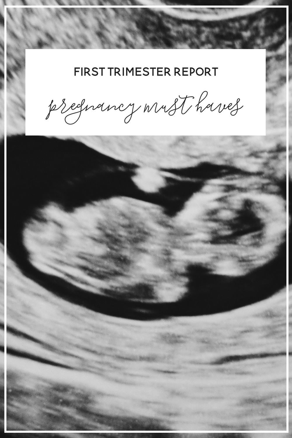 First Trimester Report + Pregnancy MUST HAVES 