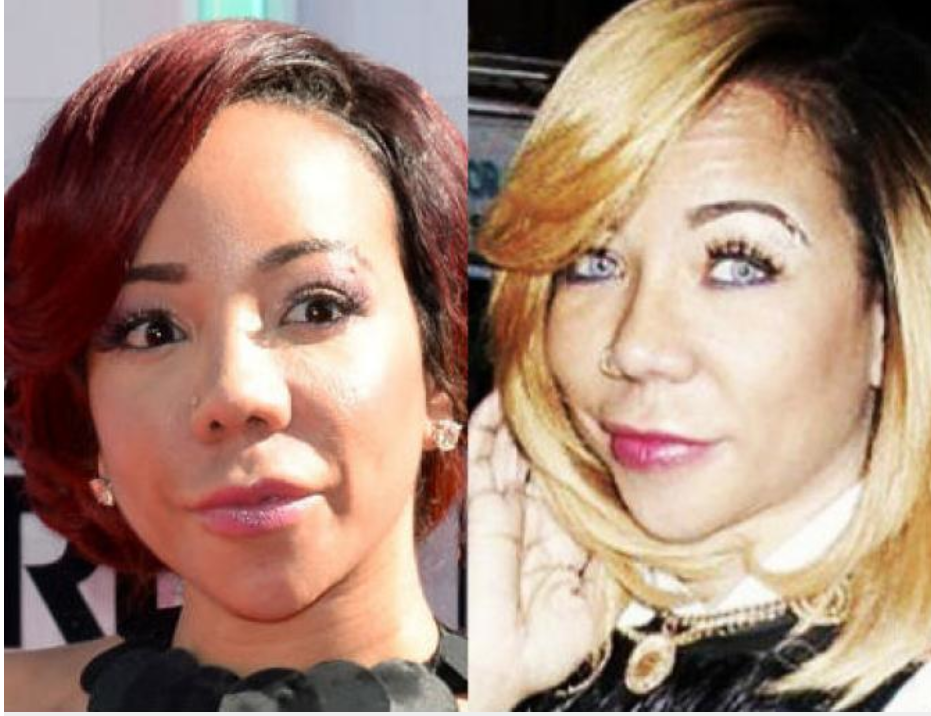 Wow! Rapper T.Is Wife Tiny Permanently Changed Her Eye 
