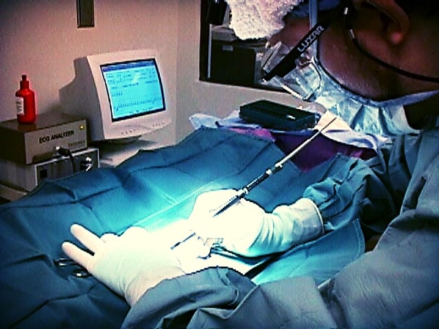CO2 laser surgery vs. surgery — Ward