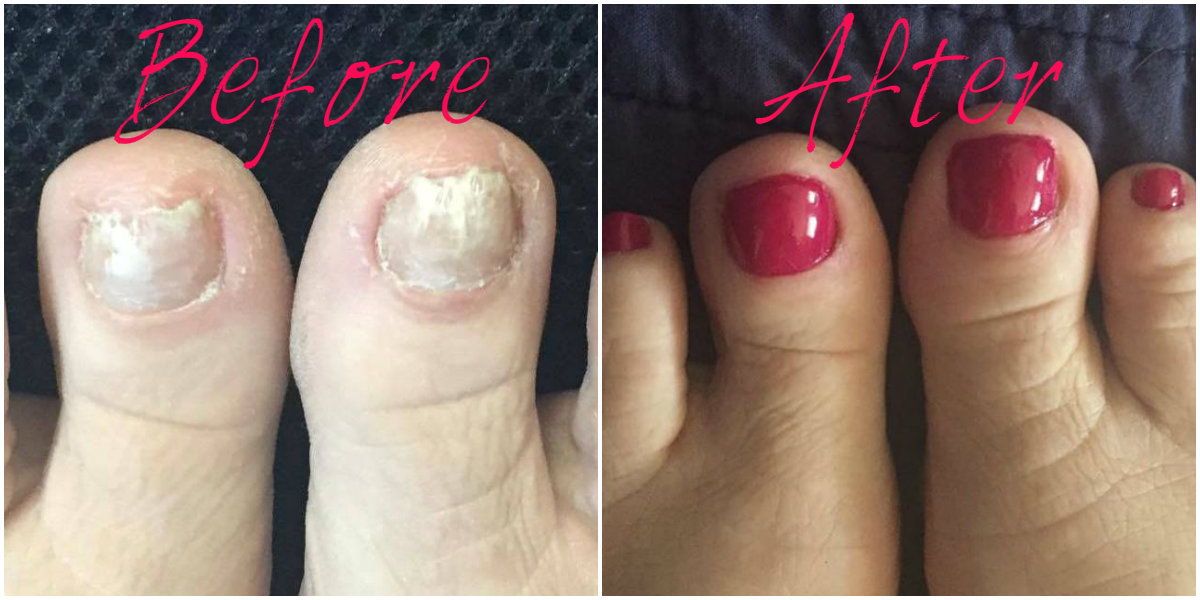 How Your Toes Can Get Their Groove Back — Nails by Geri Hall