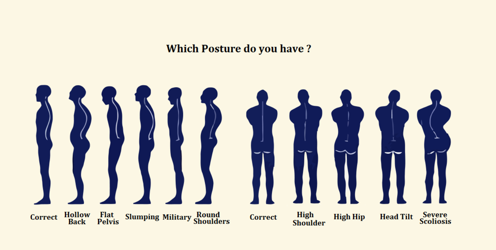  Posture Correction Scoliosis Rehab Physical Therapy correct slouching 