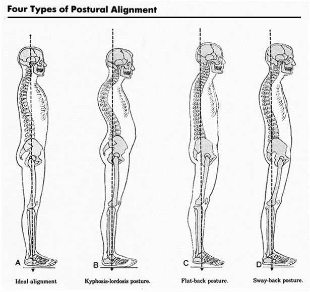 Natural Ways to Improve Posture and Align the Spine - Elliott
