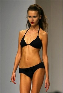 Model Carolina Reston, and victim of Anorexia  Nervosa who died in 2006 from the disorder.  Photo from BusinessEthics.com 