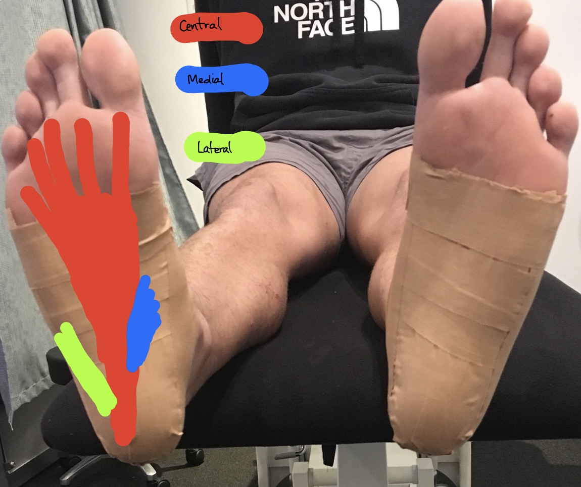 Plantar Fascia - what is it, what does it do and what makes it painful? —  Total Physiotherapy