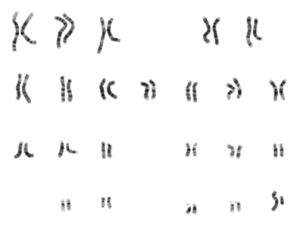 Los 23 pares de cromosomas de una célula de humano organizados en un esquema llamado cariograma.