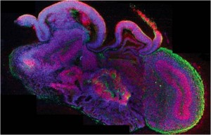 Imagen tomada de la nota fuente, que muestra un corte de los cerebritos donde se observan diferentes regiones. Las células progenitoras neurales están en rojo y las neuronas en verde. 