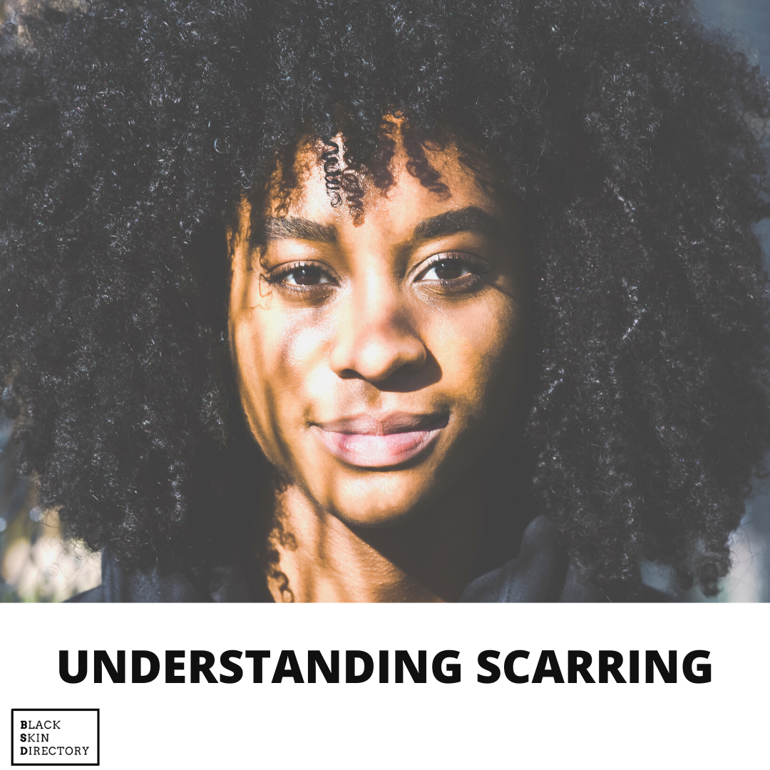 BLACK SKIN DIRECTORY | UNDERSTANDING SCARRING — Black Skin Directory
