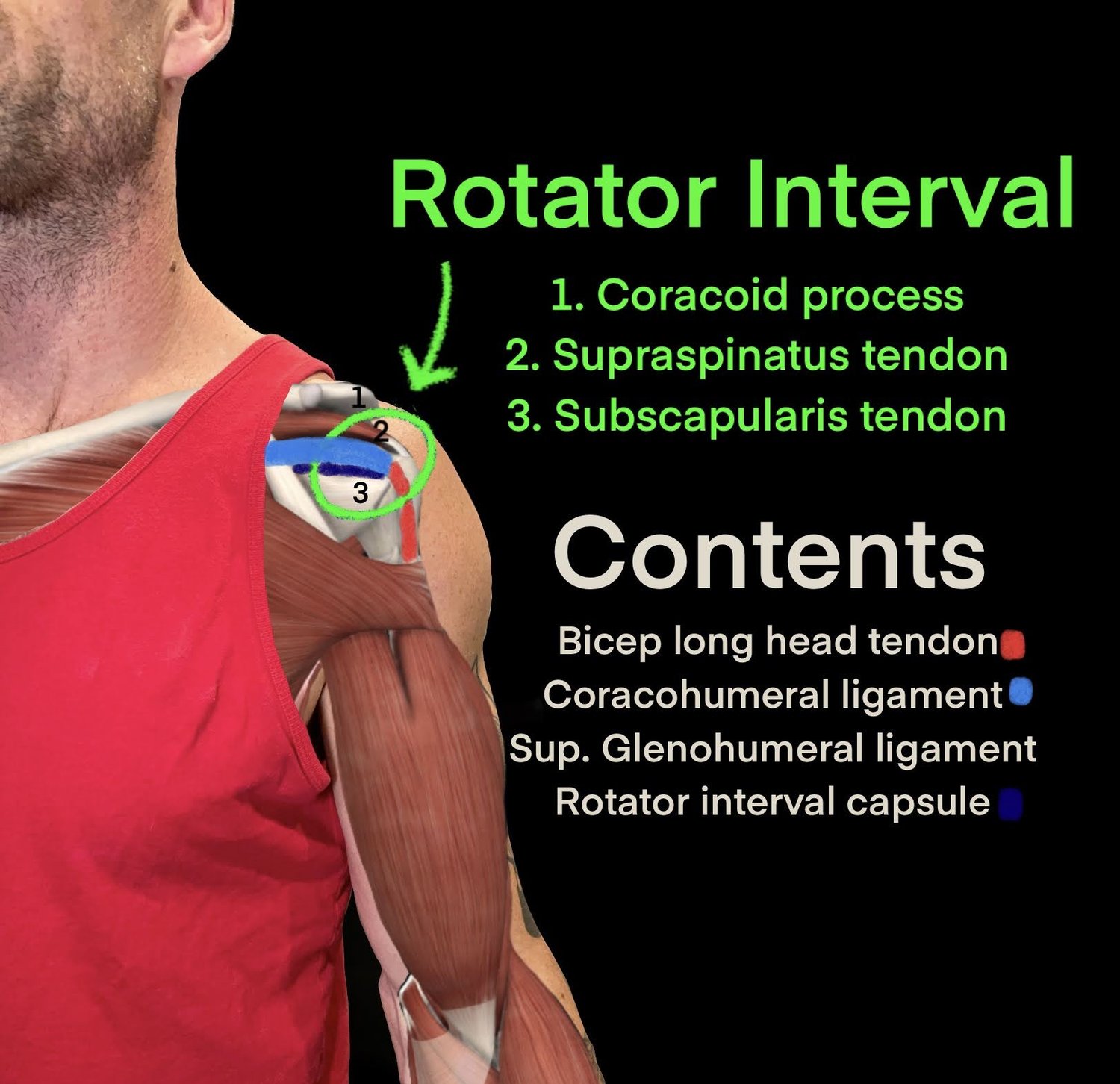 Understanding Front Side Shoulder Pain in Climbers — CAMP4 HUMAN