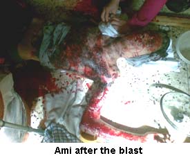 Ami Bomb Blast Images Israel Hate Crime