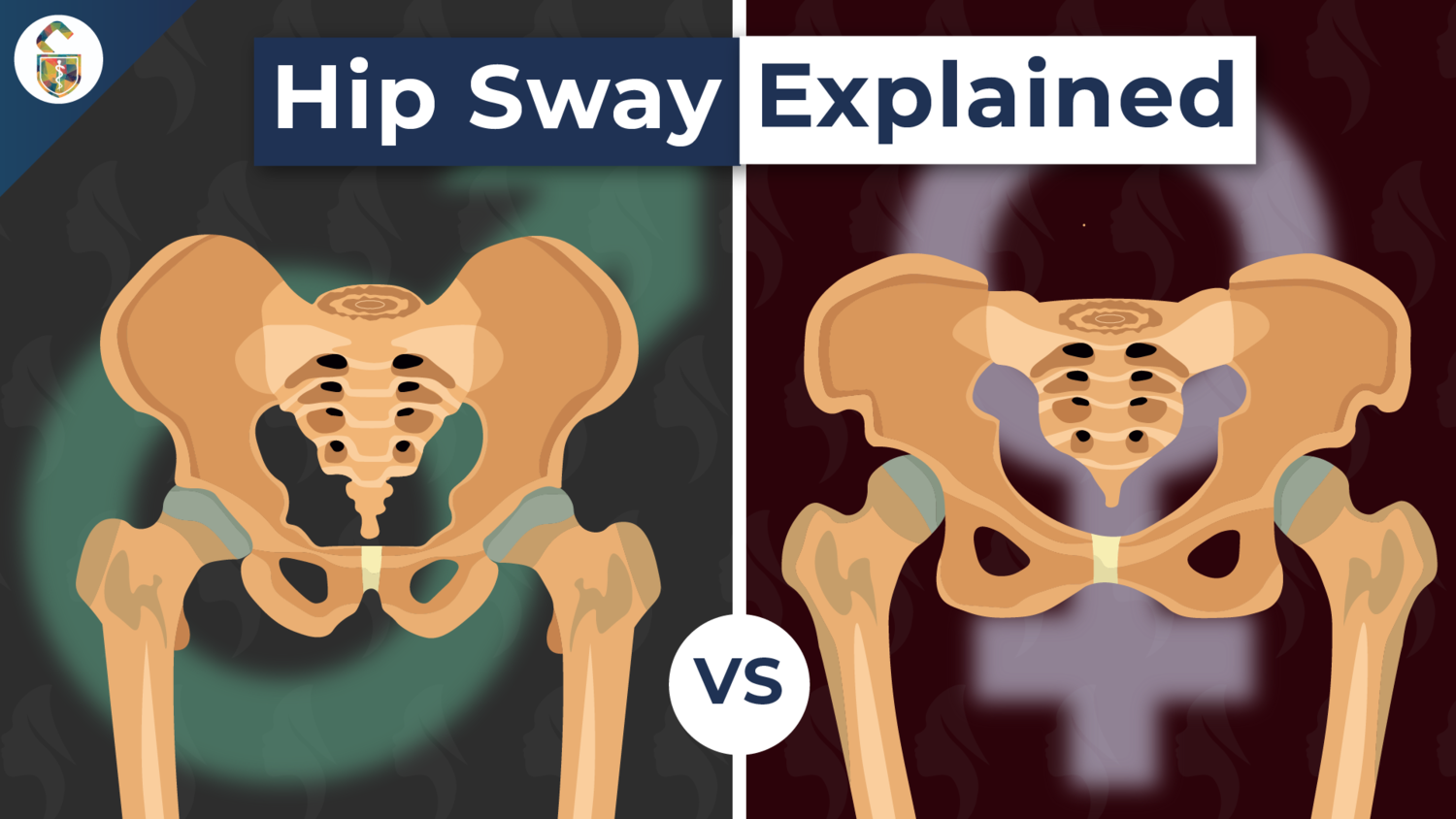 Why Do Women S Hips Sway When They Walk —