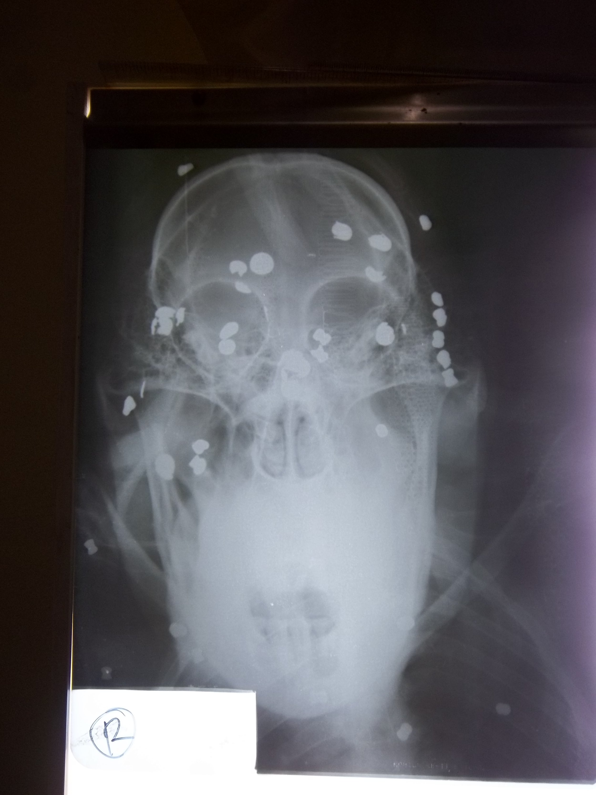 X-ray taken in 2012 of Bornean orangutan, Aan’s skull, showing pellets. Image© Orangutan Foundation.