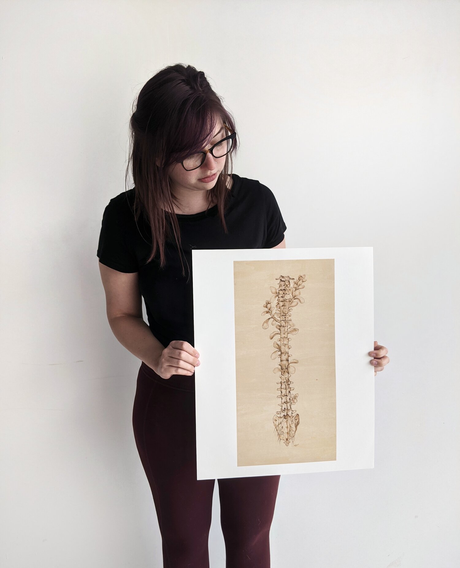 Art Print | Ankylosing Spondylitis Woodburning — unstrung studios