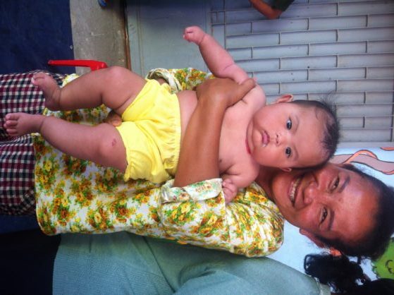 Child Rescue- a cute Cambodian baby!