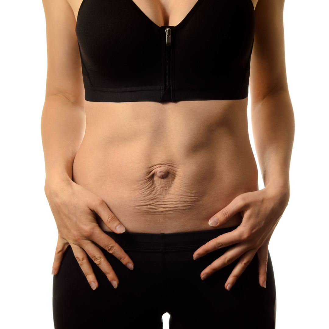 Mommy Pooch? Did your stomach never go back to normal after kids?, Pelvic Floor & Women's Health