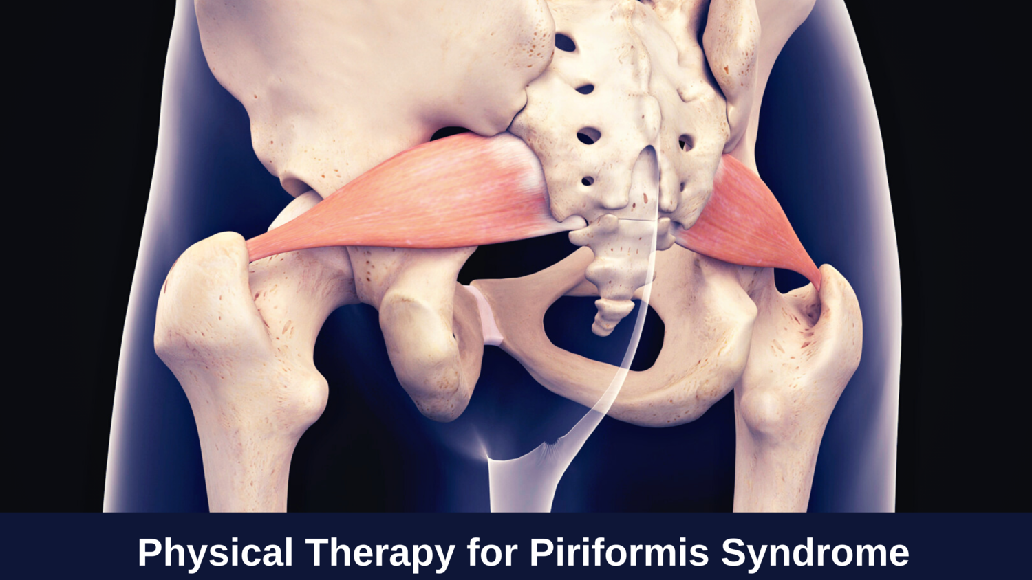 Piriformis Syndrome  Active Life Chiropractic & Wellness