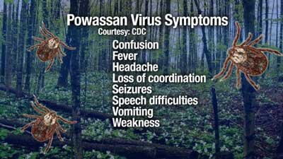 Powassan virus symptoms - CDC