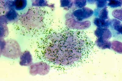 Cell infected with herpesviruses