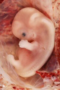 An unborn baby at 9 weeks gestational age (7 weeks after fertilisation) Photo by Ed Uthman 