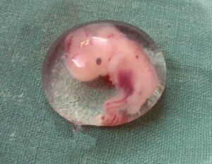 Human_Embryo