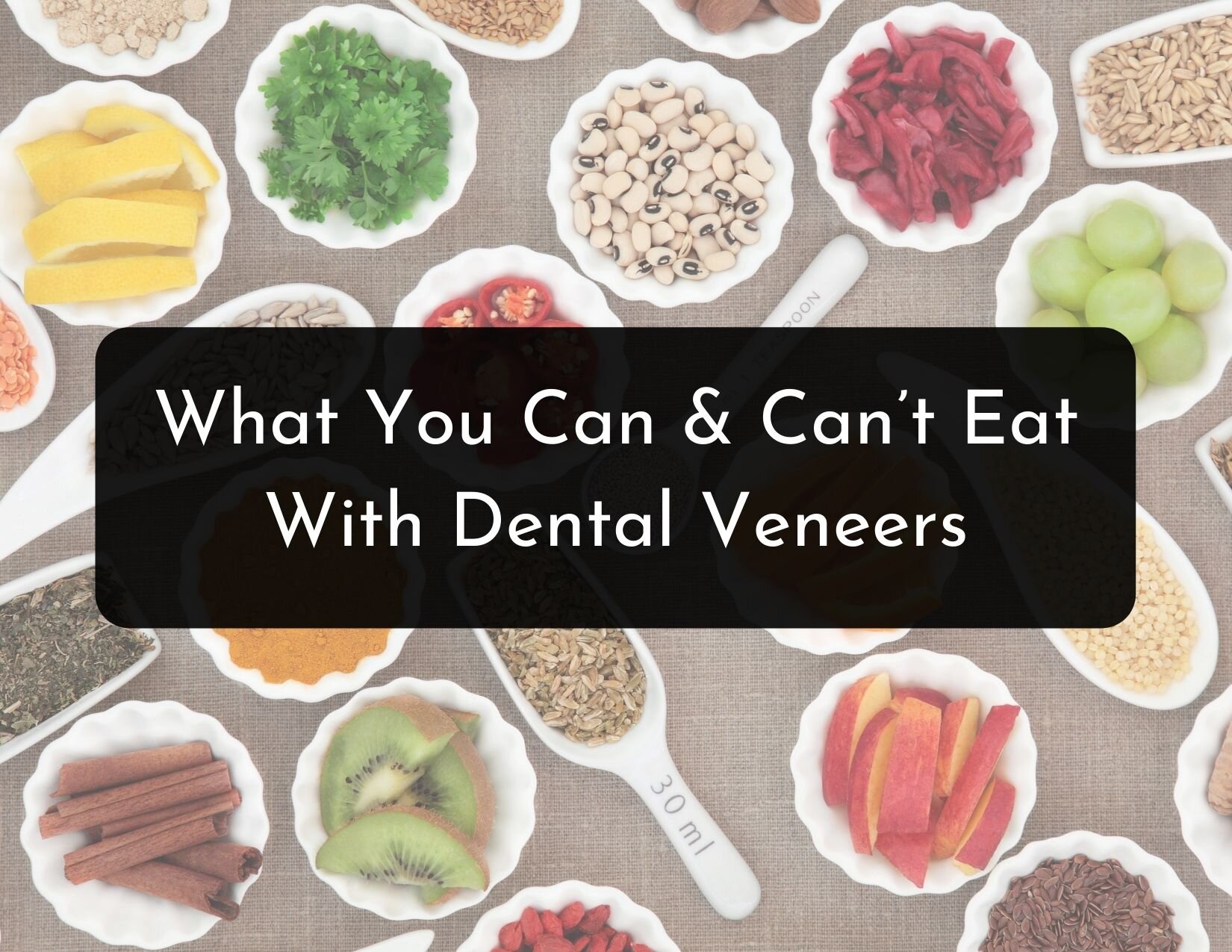 Can You Eat With Dental Veneers?
