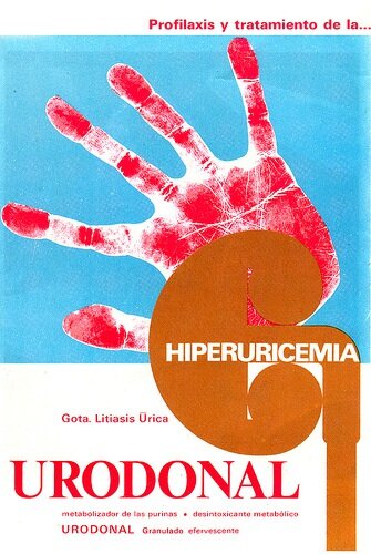 Urondonal hiperuricemia