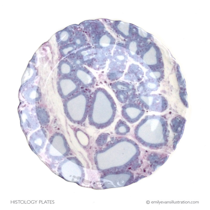 Emily Evans Thyroid Histology dessert plates available at the Street Anatomy store
