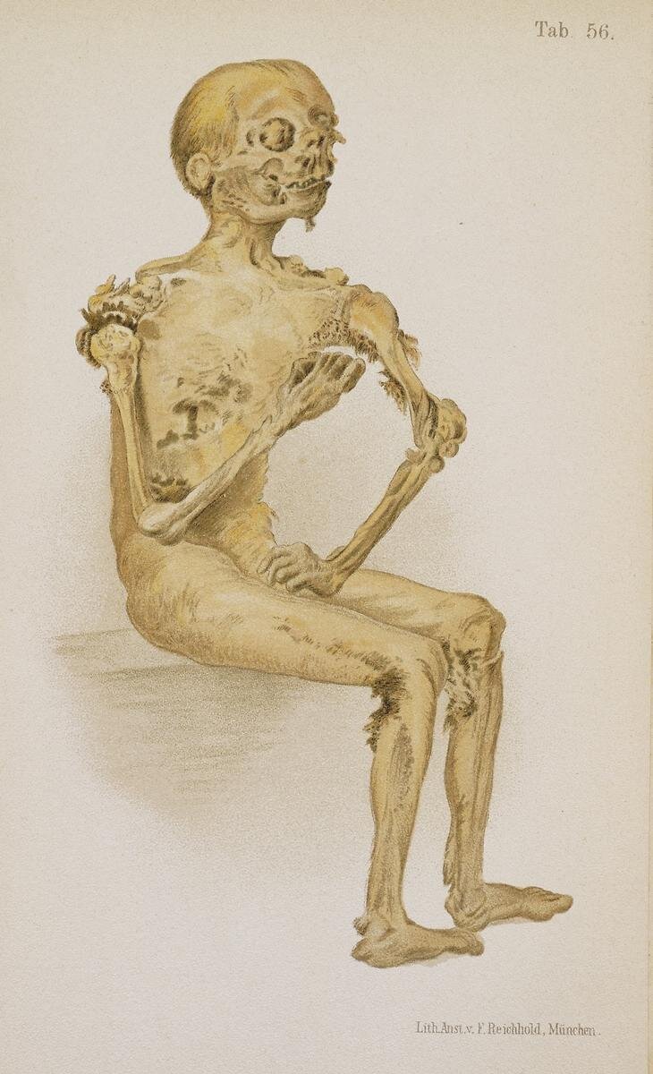 NLM Visible Proofs Mummified Cadaver 1898