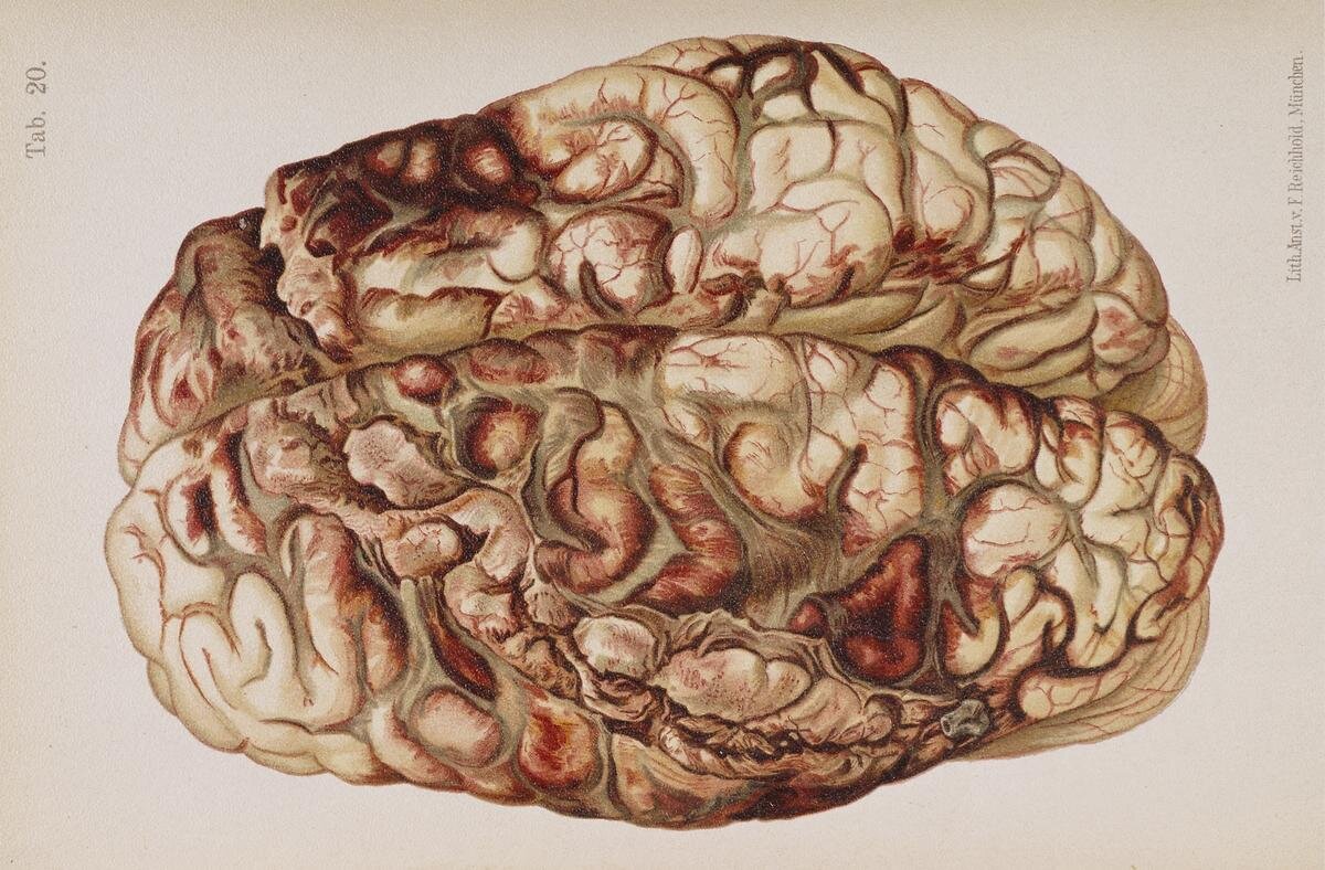 NLM Visible Proofs Gunshot Brain 1898