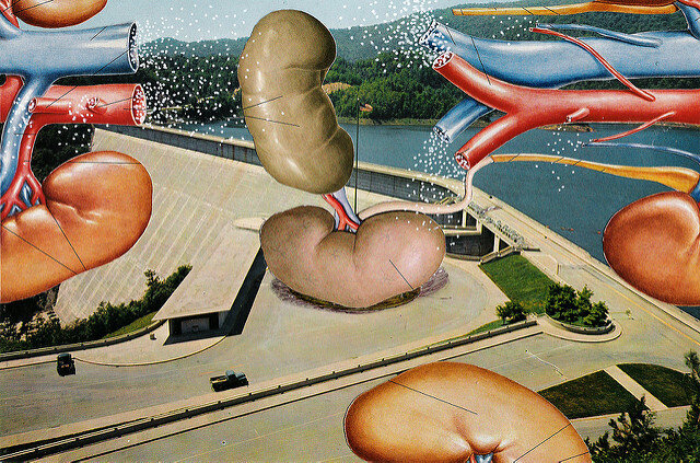 Kidneys on Parade by Richard Russell