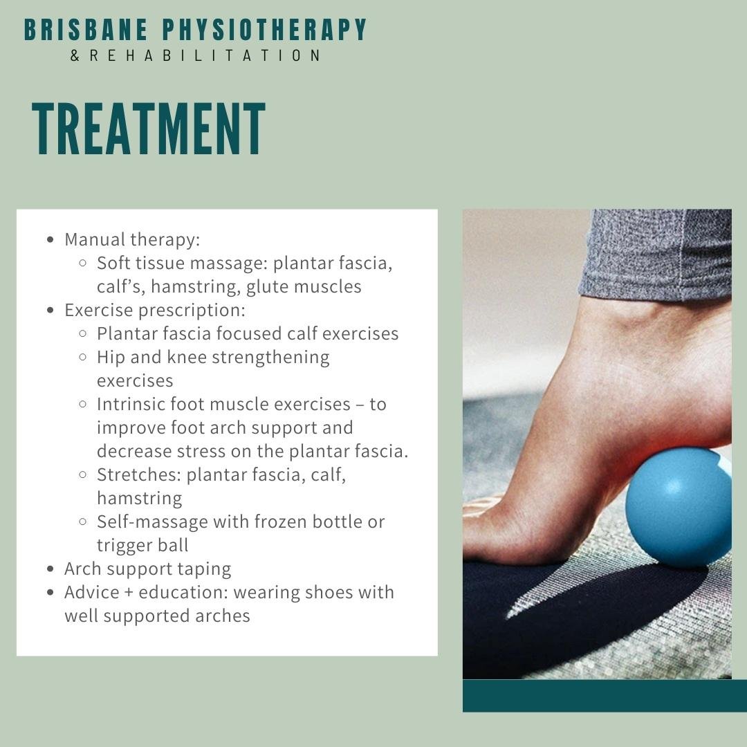 Managing your Plantar Fasciitis - Brisbane Physiotherapy