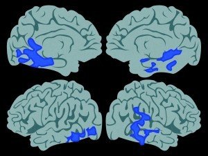 Figure 1: Brain Scan