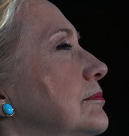 GASH ON SIDE OF HILLARY FACE RAISES CONCERNS...
