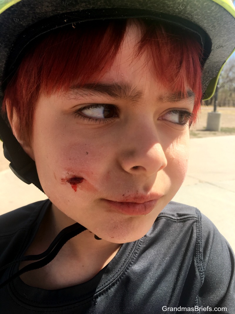 skateboard injury