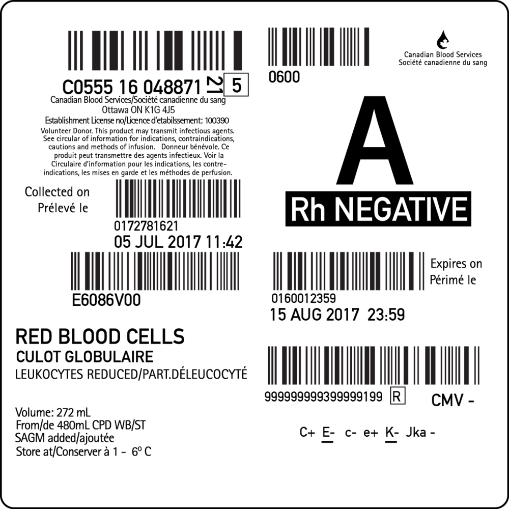 Blood Transfusion Blood Bag Label Template