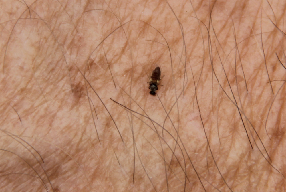 pics of bed bugs bites #10