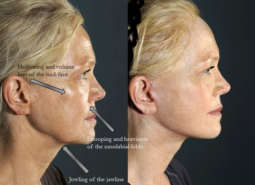 Image for plastic surgery new york