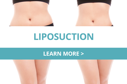  Liposuction 