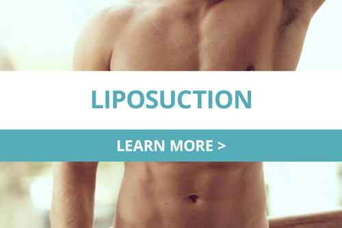  Liposuction men 