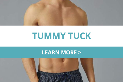  Tummy Tuck MEn 