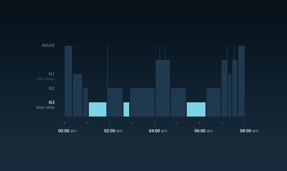 Graph of a person's sleep. The deep sleep stage in clear blue.