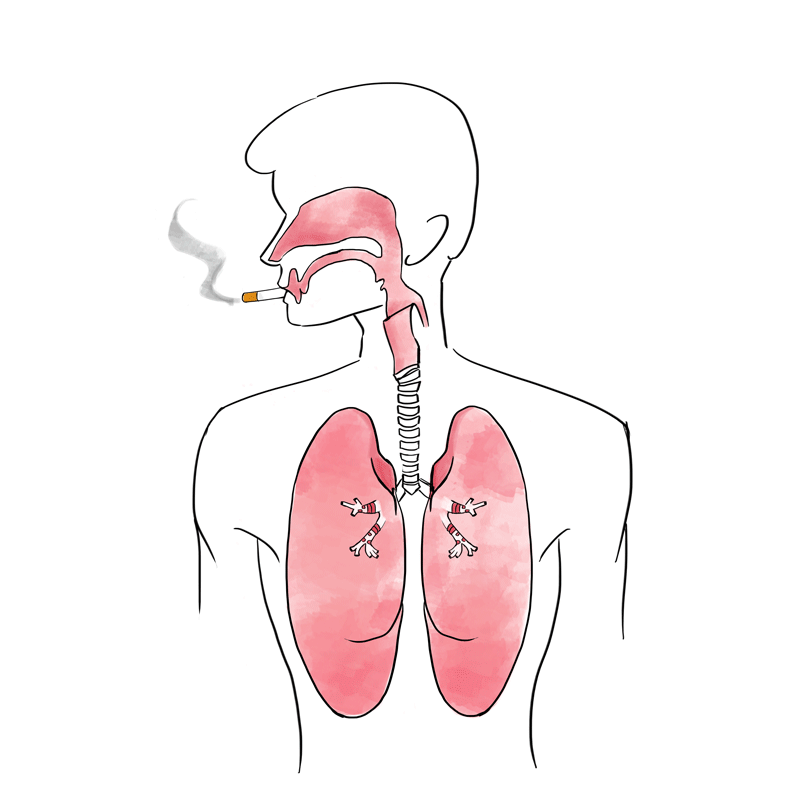 smoking-throat-cancer