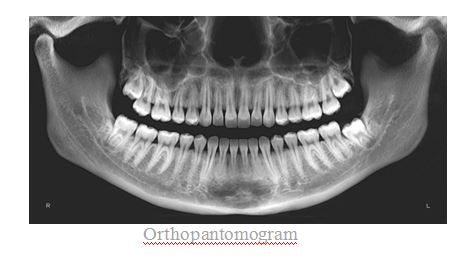 The Importance Of Dental X-Rays During An Examination — Blog