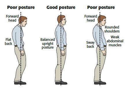 Posture Corrector - Adjustable Posture Brace, Spinal Support Belt for Men & Women, poor posture spine
